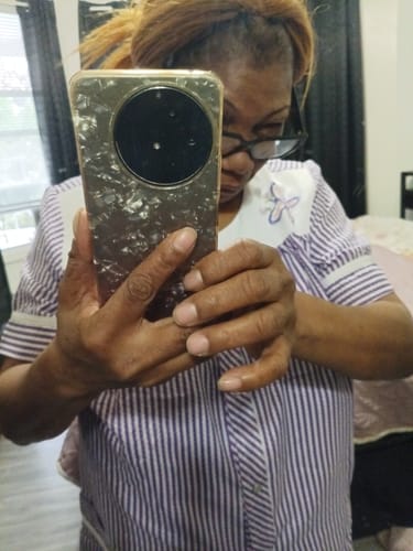 Customer taking a selfie to show new hair growth on her edges after using Rennora Hair Growth Serum.