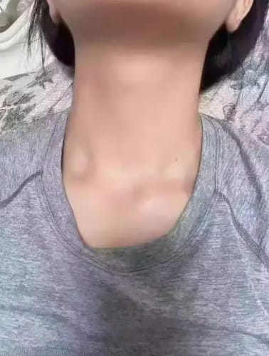 Customer photo review of Lumi Lift™