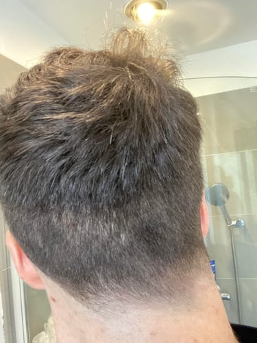 Customer photo review of Seb Natural Calming Serum