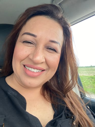 Customer photo review of Jabón de Miel y Jalea Real Eliminar Las Arrugas
