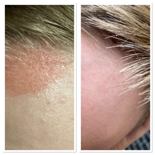 Customer photo review of Seb Natural Calming Serum