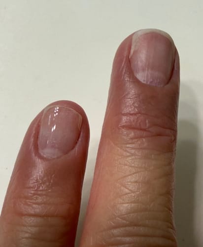Customer photo review of Sensitive Dip Powder Liquid Set