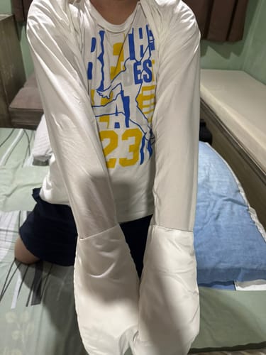 Customer photo review of Eczema Scratch Mitten