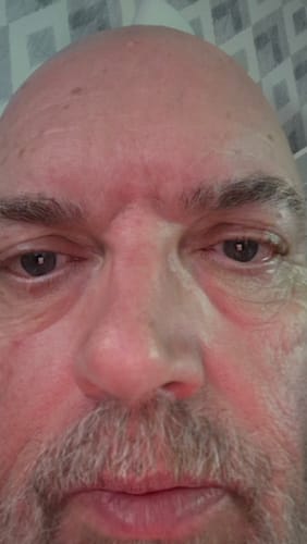 Customer photo review of Seb Natural Calming Serum