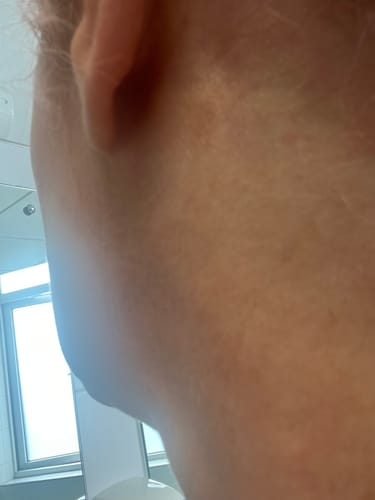 Customer photo review of Seb Natural Calming Serum