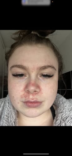 Customer photo review of Seb Natural Calming Serum