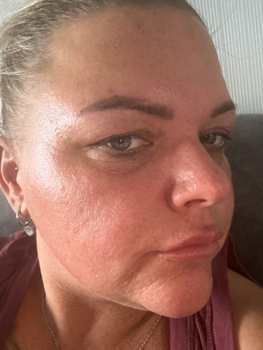 Customer photo review of Seb Natural Calming Serum