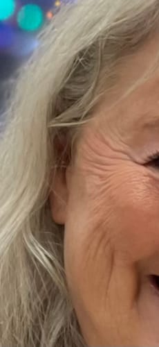 Close-up of a reviewer's face before using Koriderm™ Time Reverse Cream, showing prominent wrinkles.