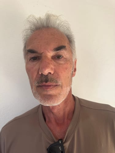 Customer photo review of PhantoMen Crema Anti-edad con Retinol+ para Hombre.
