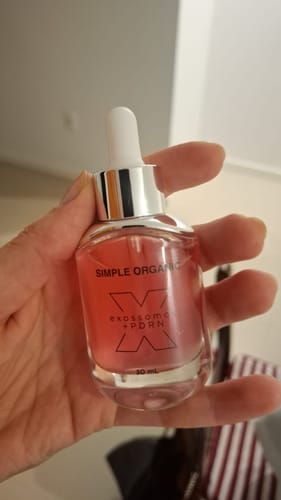 Cliente segurando o frasco de vidro da Solução Exossomos + PDRN + Peptídeos.