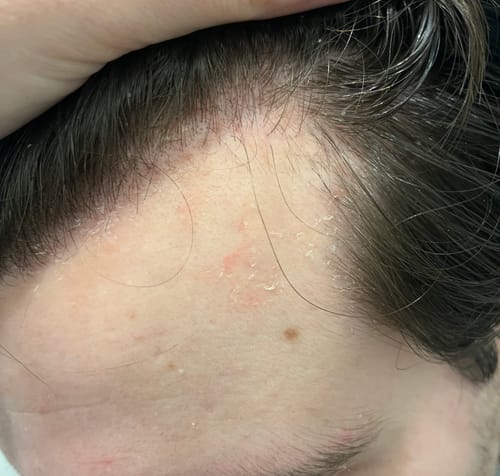 Customer photo review of Seb Natural Calming Serum