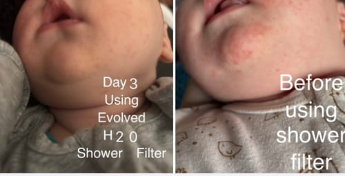 Customer photo review of Tap & Shower Filter Bundle