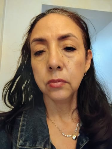 Customer's close-up photo of their face while reviewing The Micro Infusion System.