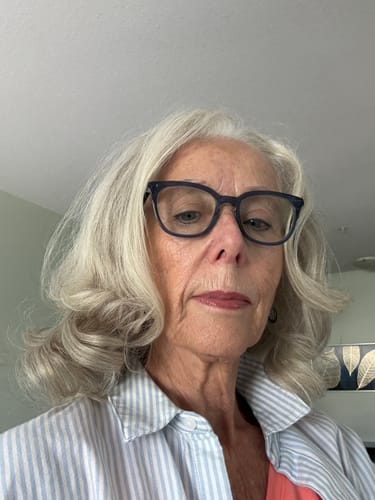Customer selfie showing her face before using F-Balm Whipped Body Butter.
