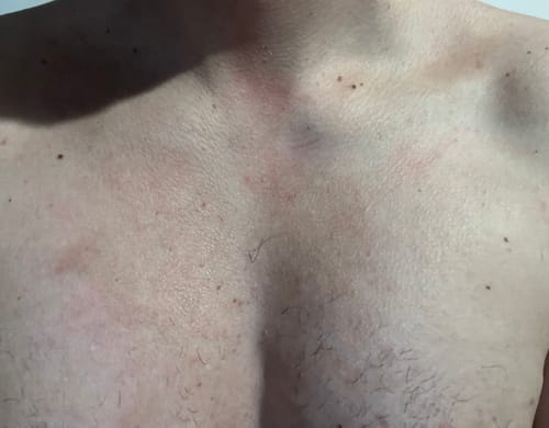 Customer photo review of Seb Natural Calming Serum