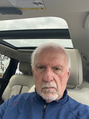 Customer photo review of Strateva Rx Anti-Aging Serum for Men — Targets Wrinkles, Eye Bags & Sagging Skin — All-in-One Skincare