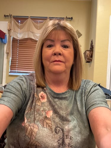 Reviewer's selfie showing skin improvements after using The Micro Infusion System.