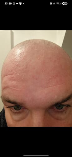 Customer photo review of Seb Natural Calming Serum