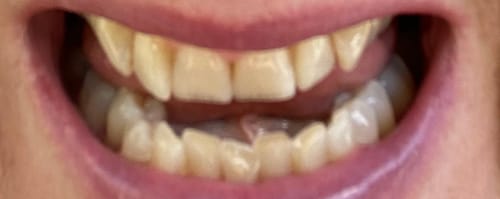 Customer photo review of Toothpaste Starter Pack