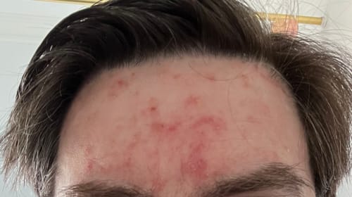 Customer photo review of Seb Natural Calming Serum