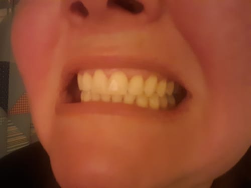 Customer photo review of Lemon Toothpaste (x4)
