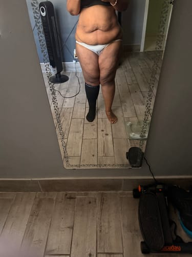 Customer photo review of Beltwell® The Original Extra Wide Compression Socks