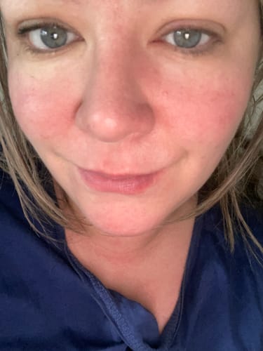 Customer photo review of Seb Natural Calming Serum