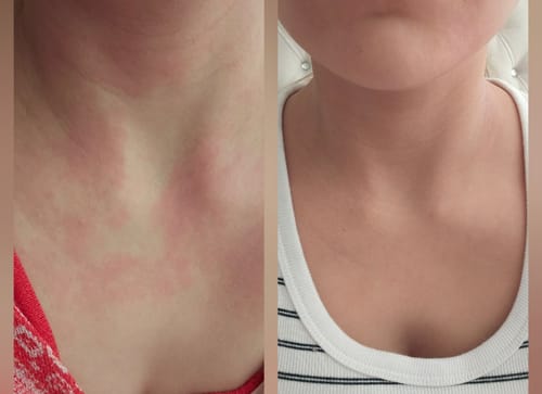 Customer photo review of Seb Natural Calming Serum