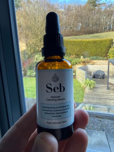 Customer photo review of Seb Natural Soothing Balm