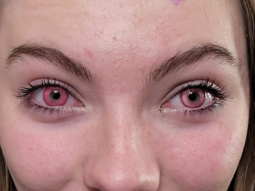 Customer's close-up showing the vivid Fairy Rose Pink colored contacts for a Nezuko cosplay.