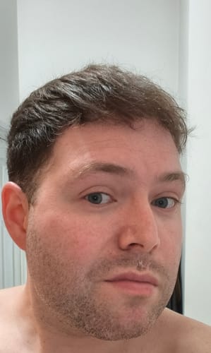 Customer photo review of Seb Natural Calming Serum