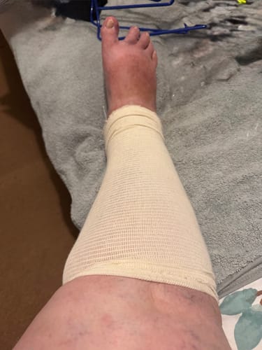 Customer photo review of Leg Protection Compression Sleeve