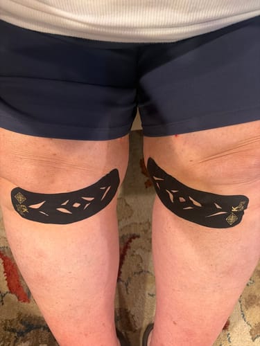 Customer photo review of Easy Kinesiology Tape (30-Day Supply)
