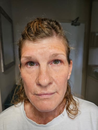 Reviewer's face after one treatment with The Micro Infusion System, showing hydrated skin and some visible fine lines.
