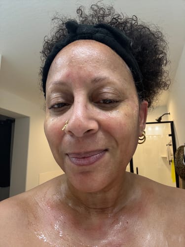 Customer smiling, showing their glowing skin after a treatment with the Seranova Microneedling Infusion System.