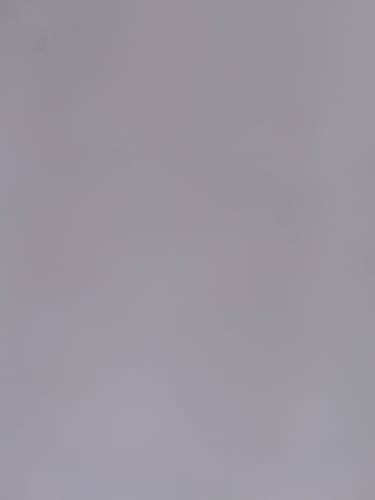 Customer's blurry and unclear image submitted with a review for F-Balm.