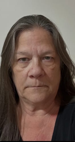 A close-up of the reviewer's face after one week of using the F-Balm tallow balm.