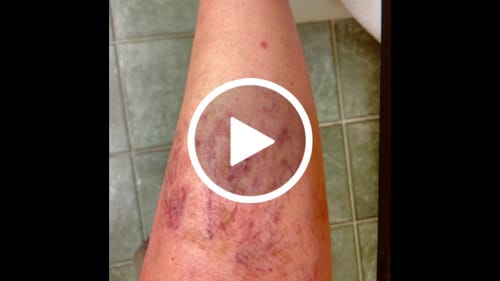 Customer video review of Besque® Magic Body Oil XL - 200ml