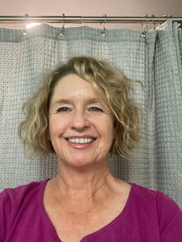 Customer smiling and showing their face, documenting skin progress with The Micro Infusion System.