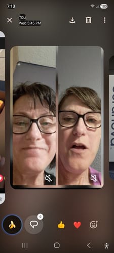 Reviewer's before-and-after comparison of their face after using The Micro Infusion System.