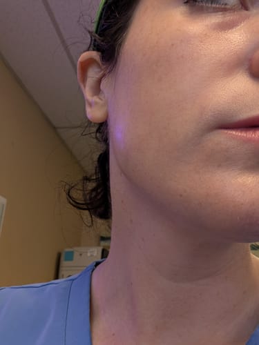 Reviewer in scrubs showing their hydrated skin after using the EGF Blue Calming Toner Pad.