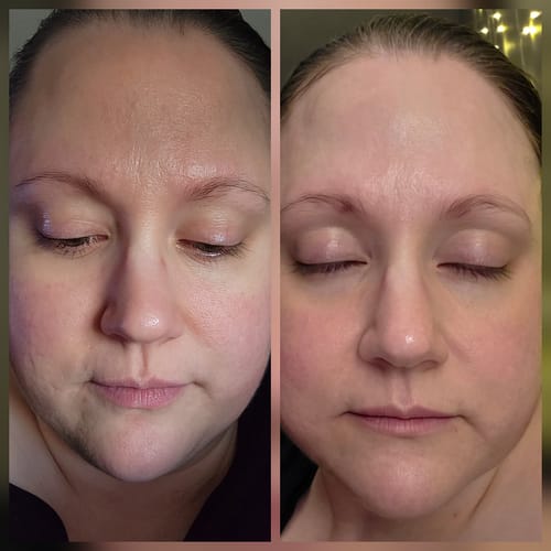 Reviewer's face in a side-by-side comparison, showing skin before and after using the Midnight Blue Barrier Kit.