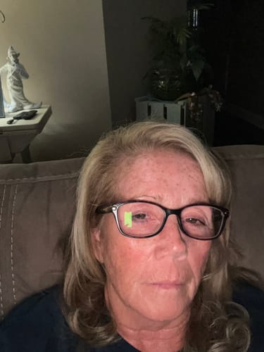 Reviewer's face after using the Micro Infusion System, shown in a dimly lit indoor setting.