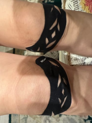 Customer photo review of Easy Kinesiology Tape (30-Day Supply)