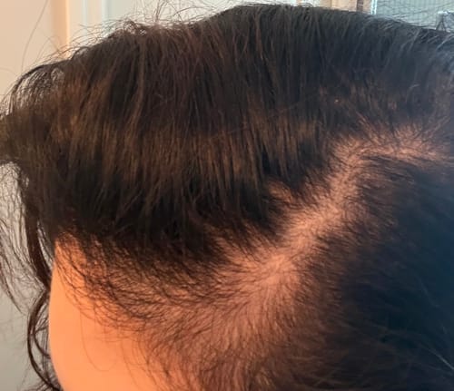 Customer photo review of Pre-Wash Scalp Oil by TR