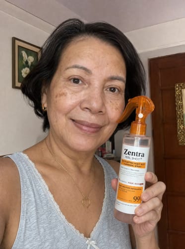 Customer photo review of Zentra - Korean Kojic Acid Peel Shot