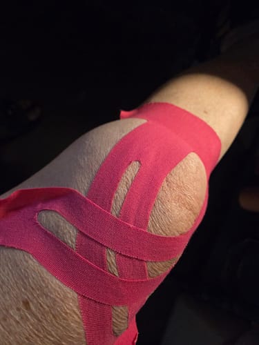 Customer photo review of APRIS™ Knee Support — Pre-Cut Kinesiology Tape