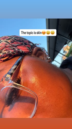 Customer's glowing skin close-up to show results after using Body Magic Chlorophyll Pill