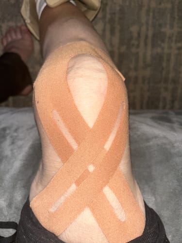 Customer photo review of APRIS™ Knee Support — Pre-Cut Kinesiology Tape