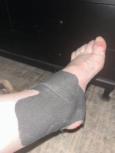 Customer photo review of APRIS™ - Ankle